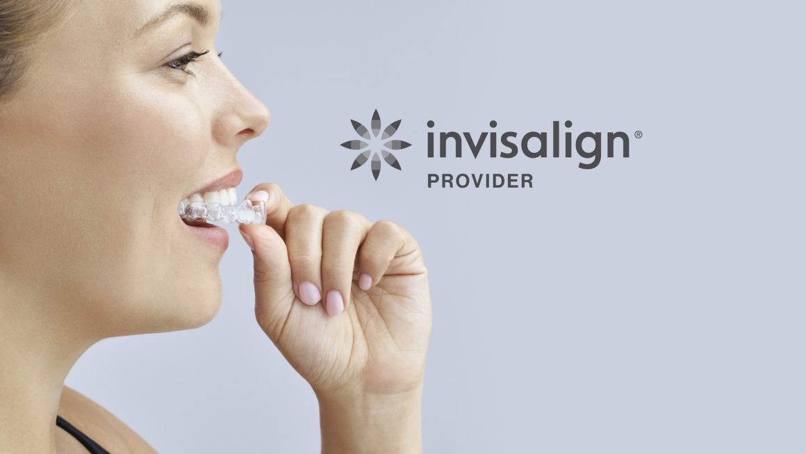 services5-next Invisalign