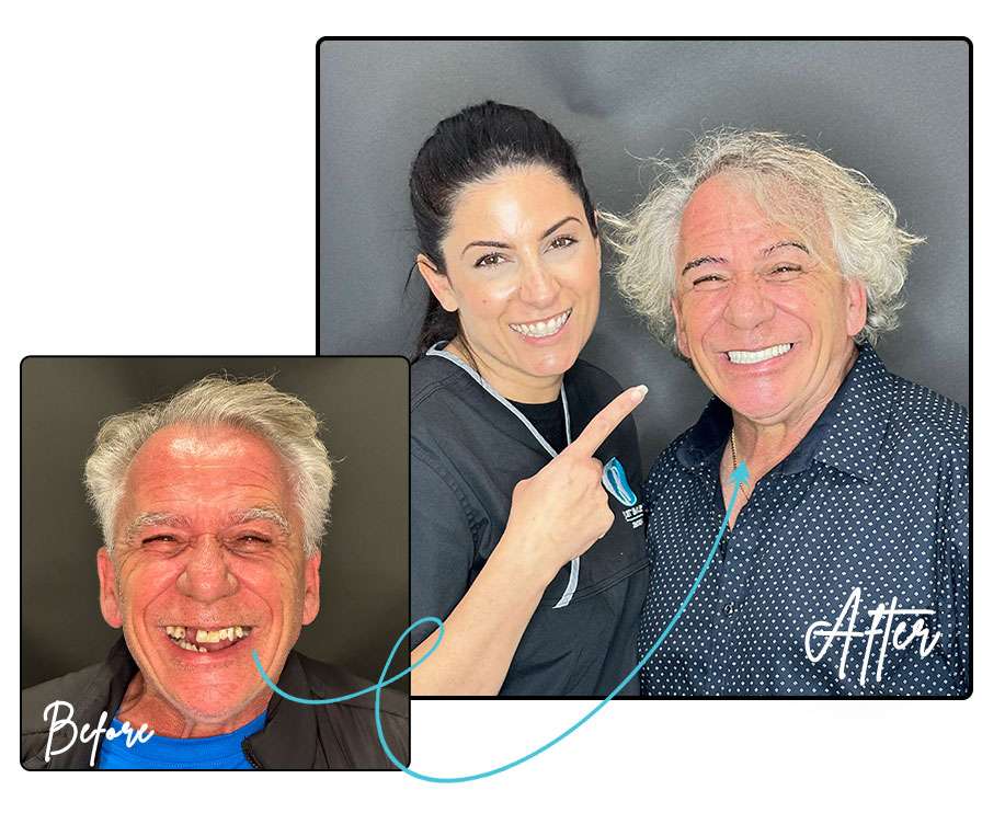 Dental Implants - Just Smiles Dentistry Ashfield