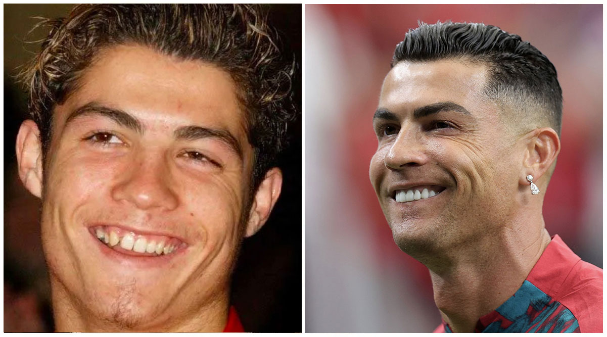 Cristiano Ronaldo — World-famous Footballer
