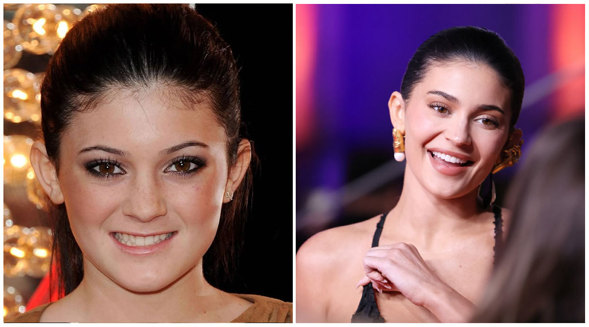 Kylie Jenner — Media Personality and Businesswoman