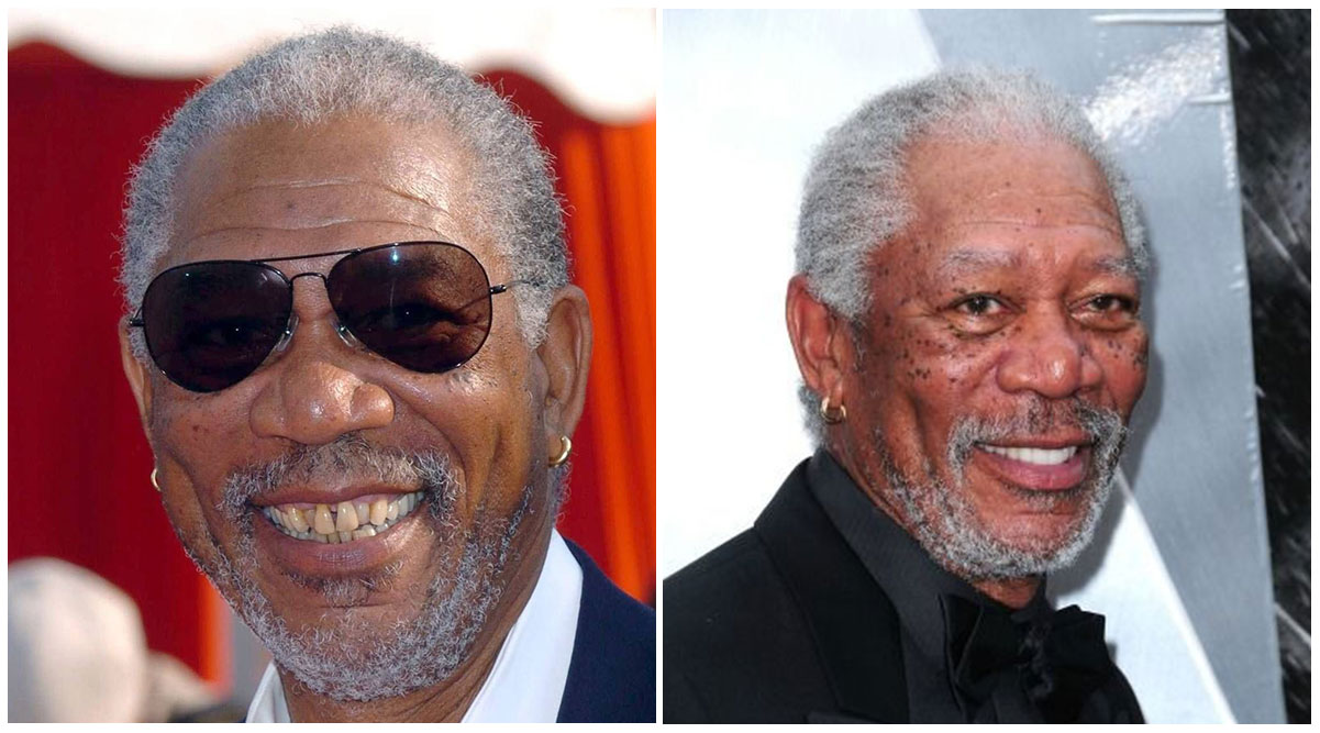 Morgan Freeman Veneers Transformation of Teeth