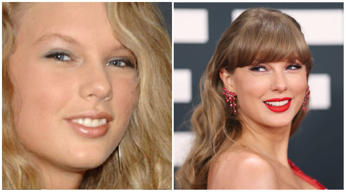 Taylor Swift Veneers Transformation of Teeth